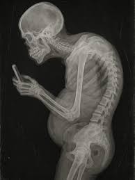 X-ray of a skeleton hunched over staring at a phone